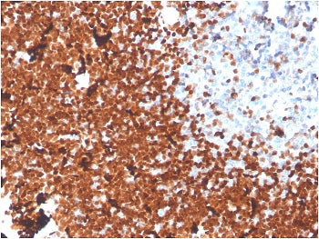 TdT Antibody