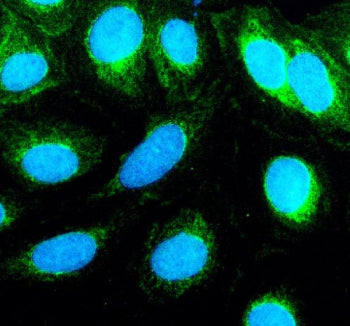 Immunofluorescent staining of TNIP3 using anti-TNIP3 antibody (green). TNIP3 was detected in an immu