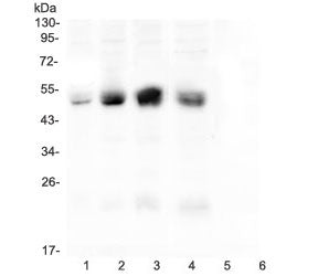 Western blot testing of human 1) A431, 2) HeLa, 3) HepG2, 4) Caco-2, 5) U973 and 6) THP1 cell lysate