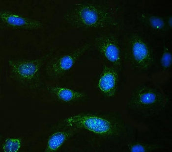 Calpastatin Antibody