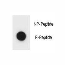 Dot blot analysis of phospho-IKKB antibody. 50ng of phos-peptide or nonphos-peptide per dot were spo