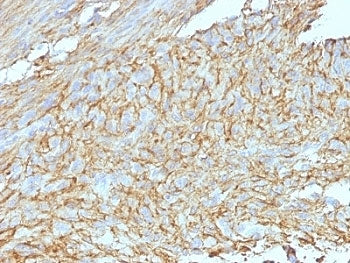DOG1 Antibody Cocktail / TMEM16A / ANO1