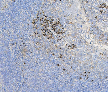 IHC staining of FFPE human tonsil with COPE antibody. HIER: boil tissue sections in pH6, 10mM citrat