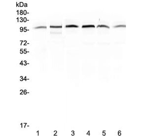Western blot testing of human 1) placenta, 2) HepG2, 3) A549, 4) PANC-1, 5) SGC-7901 and 6) MDA-MB-2
