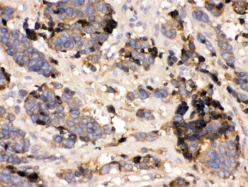 TTR Antibody / Transthyretin / Prealbumin