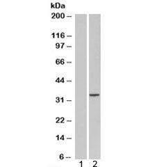 Western blot testing of HEK293 lysate overexpressing ORC6L with ORC6L antibody [mock transfection in