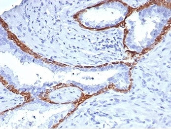 IHC staining of FFPE human prostate tissue with Cytokeratin 14 antibody (clone KRT14/4131). HIER: bo