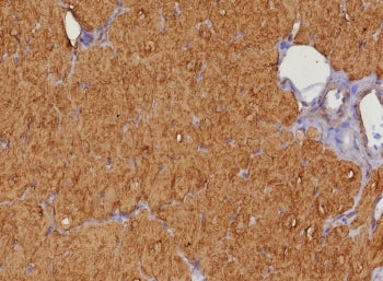 IHC staining of FFPE human heart tissue with Heart Fatty Acid Binding Protein antibody (clone FABP3/