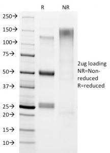 Helicobacter pylori Antibody