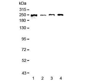 Western blot testing of human 1) MCF7, 2) COLO-320, 3) 22RV1 and 4) SGC-7901 lysate with SCRIB antib