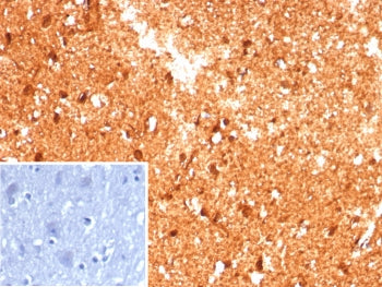 CKB Antibody / Creatine kinase B