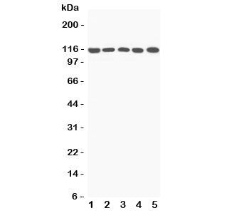 C5a Antibody / Complement 5a