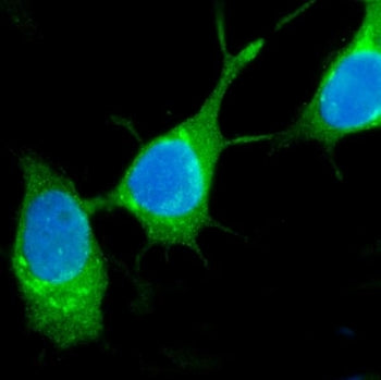 Immunofluorescent staining of FFPE human MCF7 cells with Estrogen Inducible Protein pS2 antibody (gr