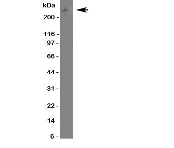 Western blot testing of ABCA4 antibody in U87 cell lysate. Predicted molecular weight ~256 kDa but m
