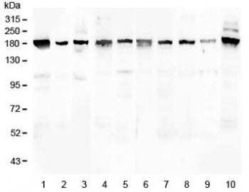 Western blot testing of 1) human placenta 2) human U-2 OS, 3) human HeLa, 4) rat brain, 5) rat lung,