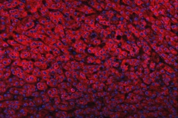 FADS1 Antibody / Fatty acid desaturase 1 / Delta-5 desaturase