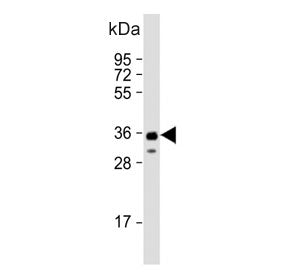 Western blot testing of human NCCIT cell lysate with SOX2 antibody. Predicted molecular weight ~34 k
