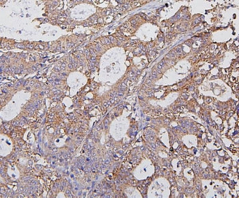 HK1 Antibody / Hexokinase 1
