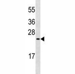 MUC1 antibody western blot analysis in MDA-MB435 lysate. This Ab will detect the 23-29 kDa isoforms 