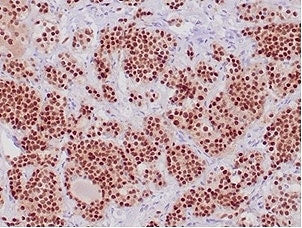 IHC staining of FFPE human pituitary tissue with POU1F1 antibody (clone PIT1/7262). HIER: boil tissu