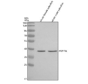 Western blot analysis of Prpf18 protein using Zebrafish Prpf18 antibody and 1) whole female zebrafis