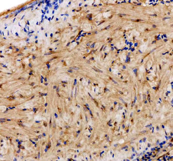 IHC staining of FFPE zebrafish heart tissue with Zebrafish Bag5 antibody. HIER: boil tissue sections