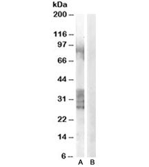 ADAM33 Antibody
