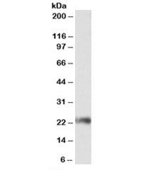 CD3G Antibody