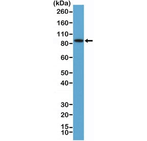 Western blot testing of human K562 cell lysate with recombinant BRAF antibody at 1:100 dilution. Pre