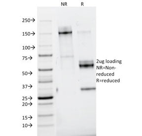 Nidogen Antibody / Entactin