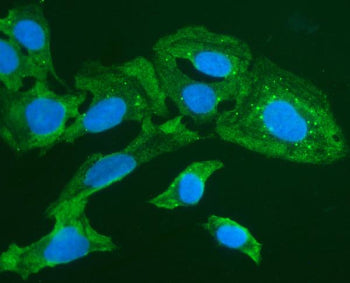 Immunofluorescent staining of FOXI1 using anti-FOXI1 antibody (green). FOXI1 was detected in immunoc