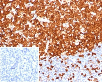 STMN1 Antibody / Stathmin 1
