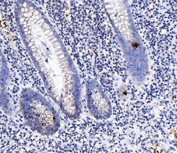 IHC staining of FFPE human appendicitis tissue with Peptide YY antibody at 1ug/ml. HIER: boil tissue