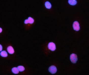 PRMT1 Antibody