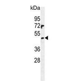 Western blot testing of human NCI-H460 cell lysate with PRAMEF6 antibody. Predicted molecular weight