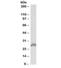 Western blot testing of HEK293 lysate with HOXB6 antibody at 1ug/ml. Predicted molecular weight: ~25
