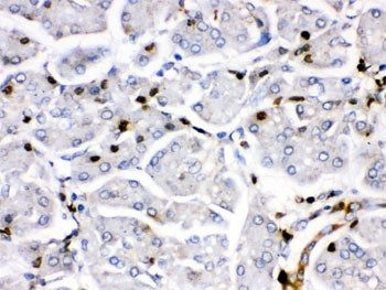 FosB Antibody