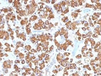 Growth Hormone Antibody / GH1