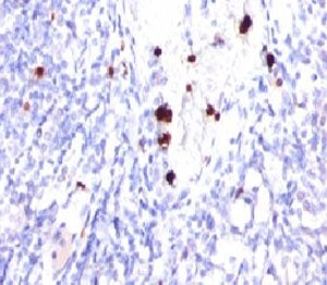 IHC testing of FFPE human tonsil and G-CSF antibody (PRPN2-1). Note cytoplasmic staining of granuloc