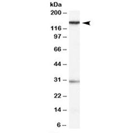Western blot testing of HeLa cell lysate with SUPT16H antibody at 0.1ug/ml. Predicted molecular weig