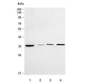 ST6GALNAC4 Antibody