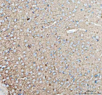 IHC staining of FFPE mouse brain tissue with TNR antibody. HIER: boil tissue sections in pH8 EDTA fo