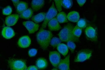 Immunofluorescent staining of FFPE human SiHa cells with Sorcin antibody (green) and DAPI nuclear st