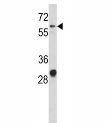 Western blot analysis of CD166 antibody and NCI-H460 lysate. Predicted molecular weight ~65 kDa (unm