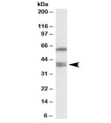 Western blot testing of HepG2 lysate with PON2 antibody at 0.2ug/ml. Predicted molecular weight: ~39