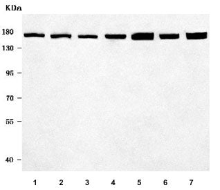 ROCK1 Antibody / Rho-associated protein kinase 1