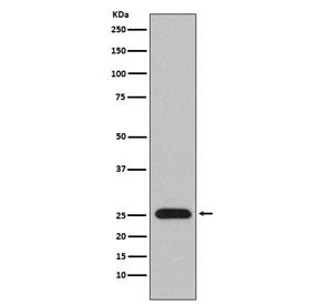 Western blot testing of human plasma lysate with Lambda light chain antibody. Predicted molecular we