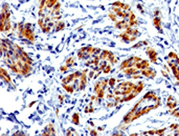IHC testing of FFPE human uterus with recombinant CAD antibody (clone RMCDN1-1). HIER: steam section