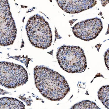 SAP130 Antibody / Sin3-associated polypeptide p130