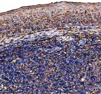 IHC staining of FFPE human tonsil tissue with IL7RA antibody, HRP-secondary and DAB substrate. HIER: